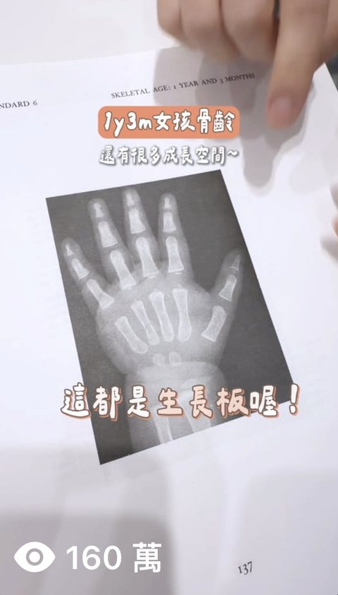 兒童成長門診 短影音,觀看 160萬